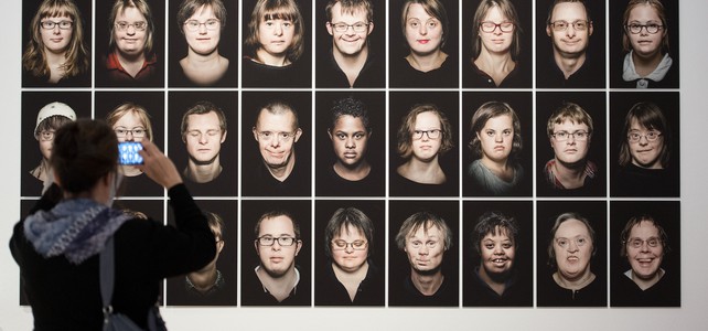 Down-Syndrom führt oft zur Abtreibung